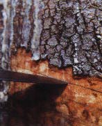 Incision of the trunk